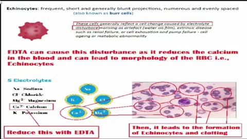 Here's Why We See Massive Blood Clots in The Vaxxed