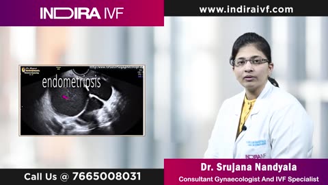 Endometriosis Causes: Know What Causes Endometriosis at Indira IVF