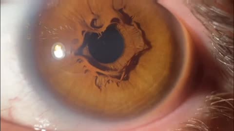 Unique Eye Iris