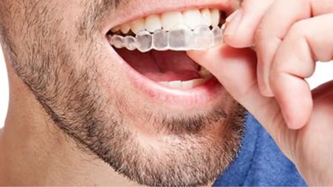 Lujan Dental : Clear Braces in Tamiami, FL