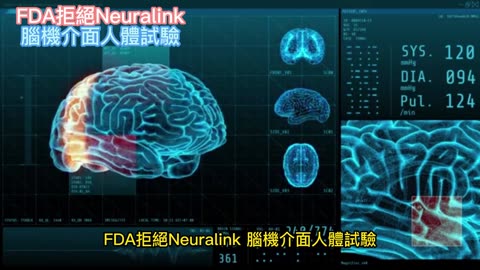 FDA拒絕Neuralink 腦機介面人體試驗