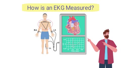 What is an Electrocardiogram? (EKG/ECG) *SIMPLE Explanation*