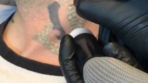 taking out tattoo
