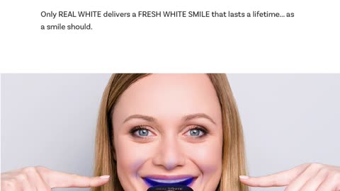 Professional teeth whitening