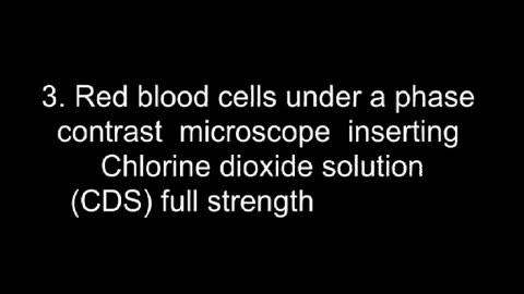 SANGRE EN MICROSCOPIO ANTES Y DESPUES DEL DIOXIDO DE CLORO