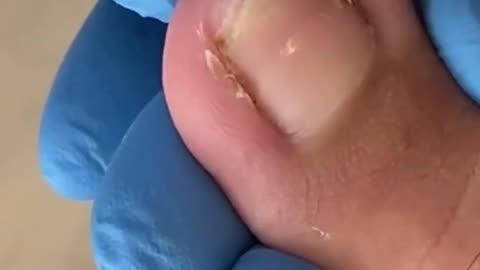Satisfying pedicure video!