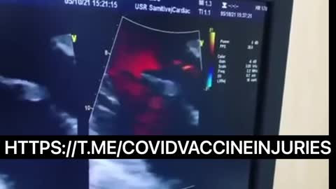 Vaccine Victim Florian Dagoury