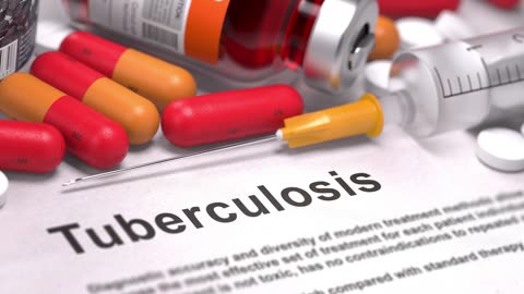 US Tuberculosis Cases Rise, Highest Numbers In A Decade, Non-Citizens