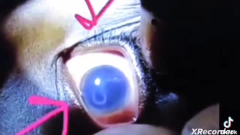 Child's Eyes after death from the jab