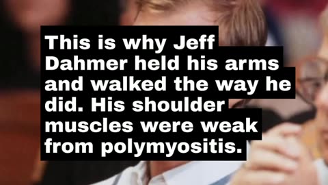 Jeff Dahmer Had Polymyositis. The Story Collapses As He Was Incapable Of Doing What the MSM said