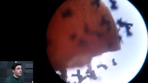 Black_Mould_Colony_UPDATE_(Under_The_Microscope)
