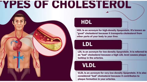 ApoB - the new way of saying "high cholesterol"