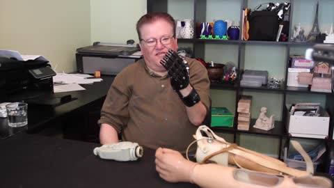 A $50 3D-Printed Prosthesis Compared to a $42,000 Myoelectric Prosthesis