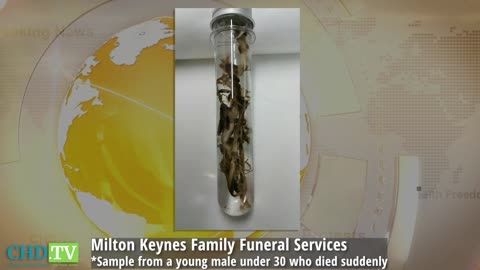 John O'Looney U.K. Funeral Director Reporting Fibrous Clots Clogging Arteries
