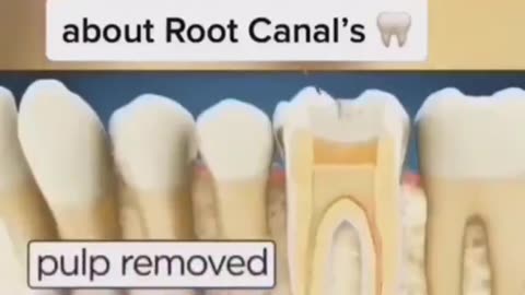The shadowy secret world of dentistry the medical malice of the dreaded root canal!!!