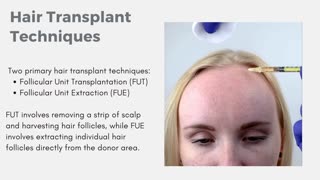 Hair Transplant for women