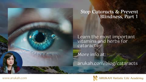 Stop Cataracts & Prevent Blindness, Part 1 - Home Remedies