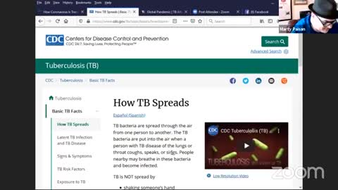 TB vs COVID