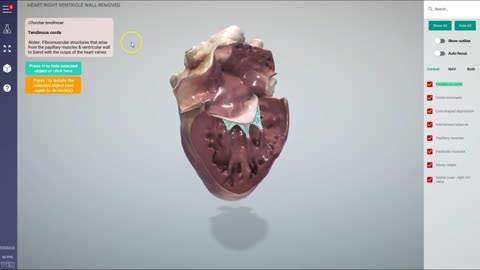 Canine heart right ventricle removed - 3D Veterinary Anatomy & Learning IVALA