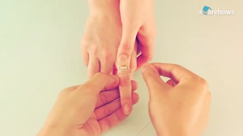 removing rings from the hand