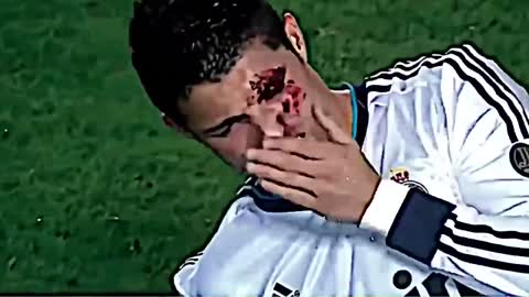 The most dangerous injury in football history