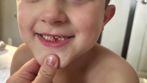 A boy lost his first milk tooth 🦷