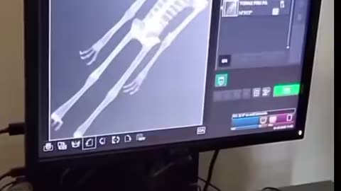 Mexican Government Releases Video of Mummified “Alien” Internal Bone Structure