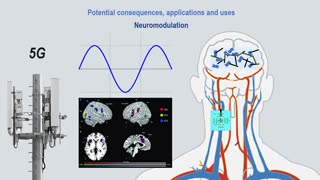 Intra-body nano-network - Part 4 of 5 - Intra-body nano-network - Part 4 of 5 - Possible Uses: Mind-control & Population control: Neurosurveillance, Neuromodulation, Neurostimulation, Human connectivity