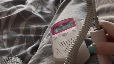 Frenchie hears baby’s heart beat for the first time.