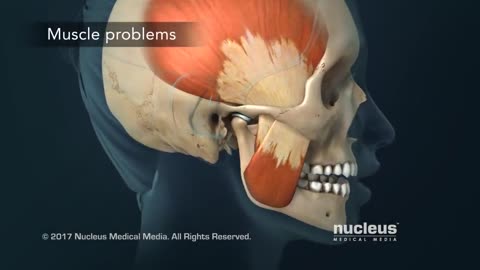 TMJ Pain Headaches, Earaches and Spasms