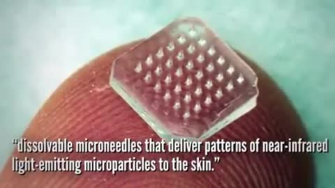 Micro-needle Vaccine Patch: Bill Gates up to no good as always.