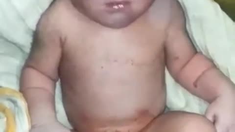 Disabled Child born Somewhere in India