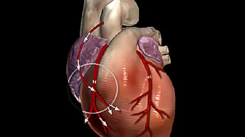 How Does Heart Bypass Surgery Work_ Coronary Artery Bypass Graft Procedure Animation - CABG Video