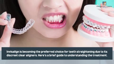 Your Guide to Invisalign Basics