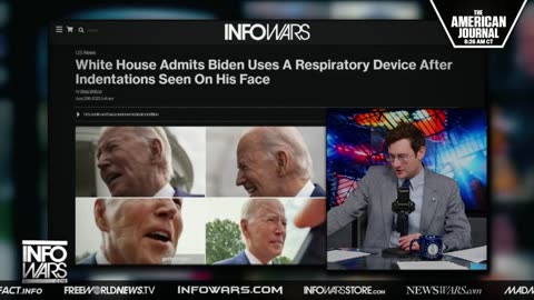 Bizarre Marks On Biden’s Face Leave Americans Questioning His Private Activities