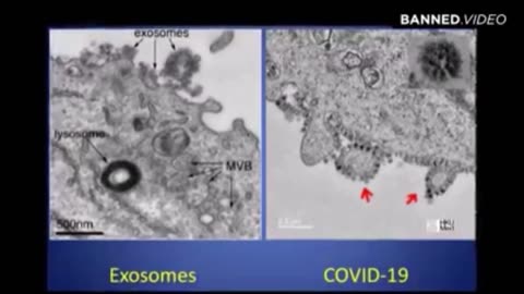 5G Technology and Induction of Coronavirus In Skin Cells...