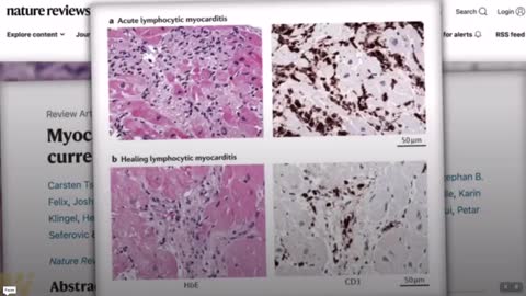 Dr. Ryan Cole on Child Heart Damage by Vaccine