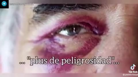 España| El personal de seguridad Privada es víctima de varias agresiones físicas