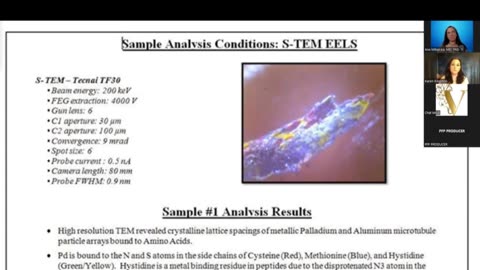 Hydrogel Bioweapon & Nanotechnology in C19 shots - Ana Maria Mihalcea, MD, PhD