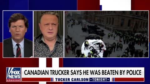 Trucker Pummeled by Ottawa Police: “they broke my body a little bit but not my spirit”