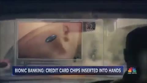 BIONIC BANKING: CREDIT CARD CHIPS INSERTED INTO HANDS & CENTRAL BANKS ARE PREPARED. Revelation 13;16