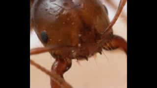 Fire ant bite and sting up-close!