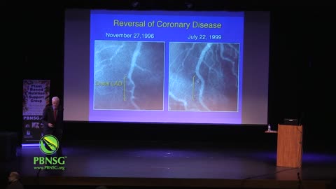 Treating the Cause to Prevent and Reverse Heart Disease with Dr. Caldwell Esselstyn