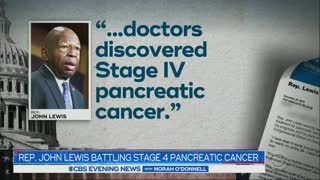 CBS Shows Cummings Face During John Lewis Cancer Story