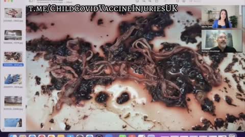 Huge fibrous structures being found in the vaccinated by embalmers.