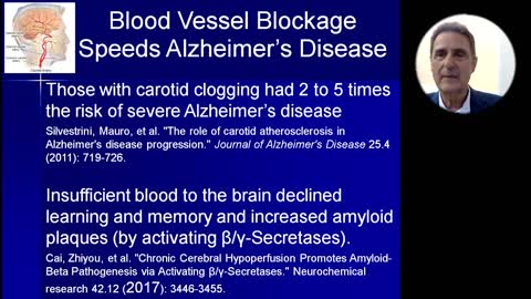 Those With Atherosclerosis Are More Likely To Have Vascular Dementia