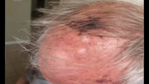 77-year-old veteran attacked for wearing MAGA hat