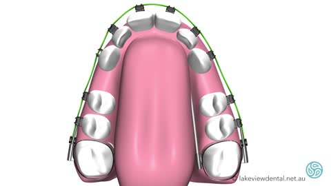 Dental Orthopedics