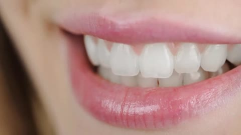 Natural Teeth Whitener REVIEW 2022