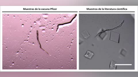 Vacuna C19 -¿Ahora lo entiendes?